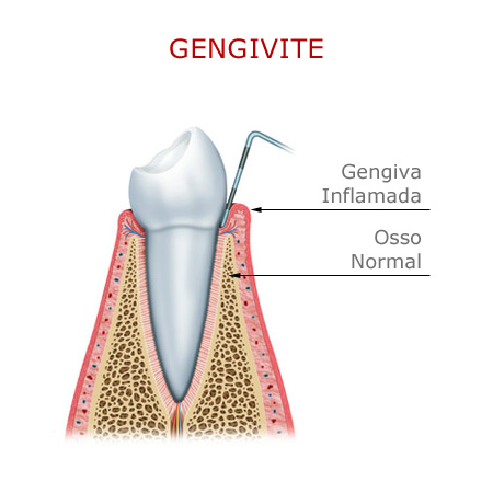 Periodontia em Santos