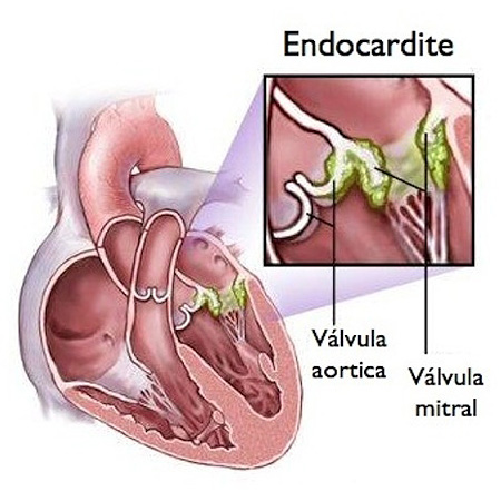 Periodontia em Santos