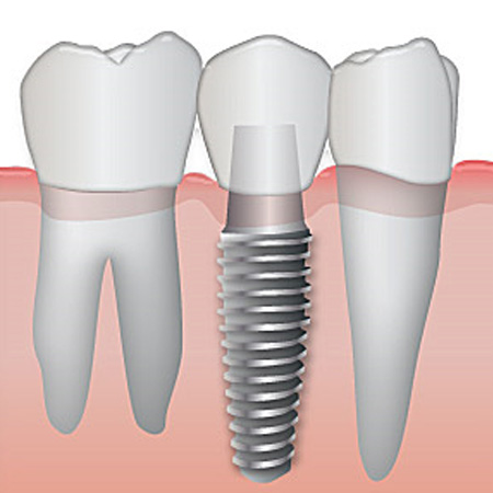 Periodontista em Santos