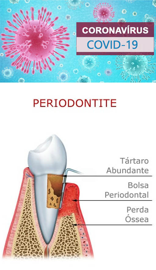 Periodontista em Santos